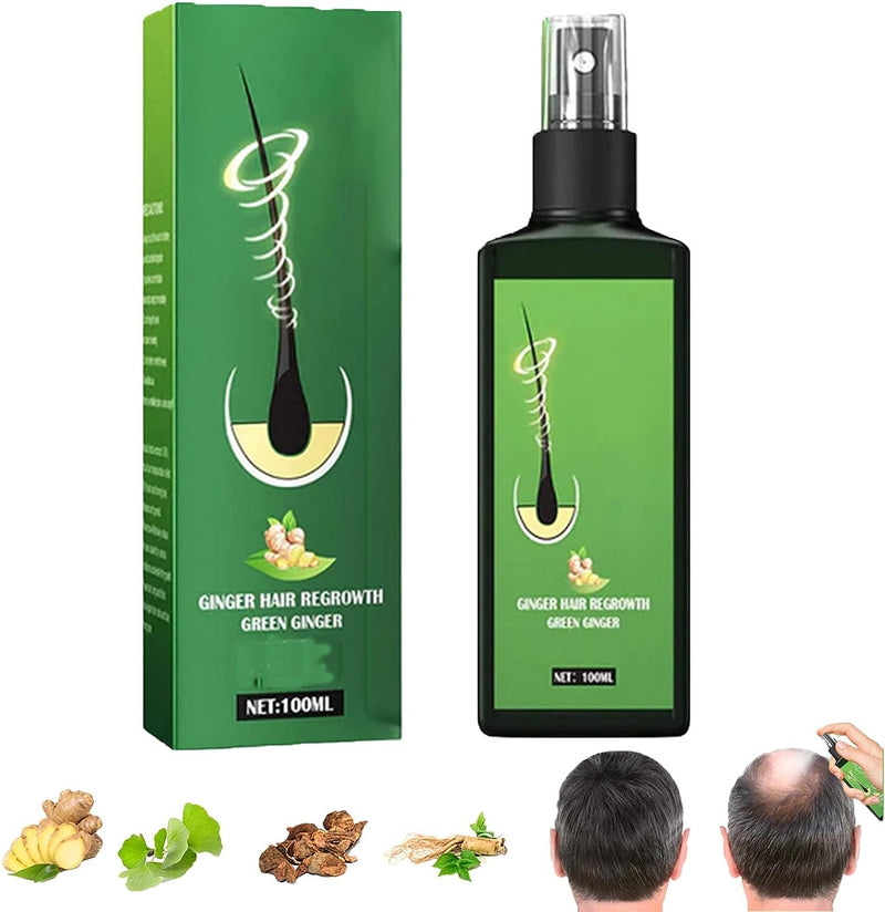 🎗️ Aceite Crecimiento Cabello 10X más rápido 🎗️